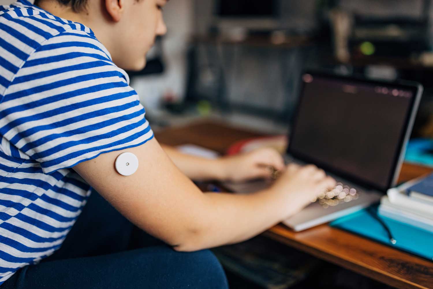 A boy wearing a diabetic patch on his arm uses a laptop.