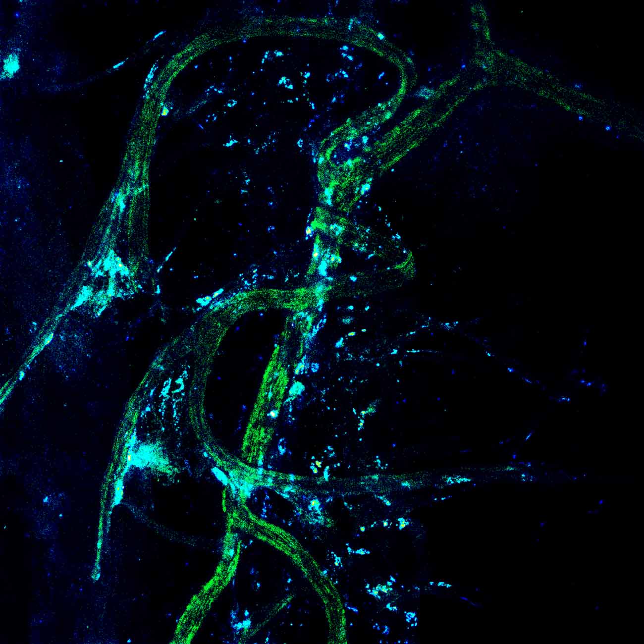 A microscopic image of pain signals traveling down nerve cells.