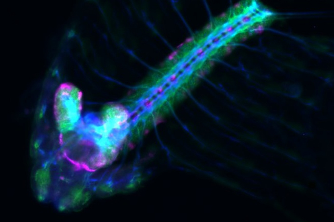 Drosophila Brain