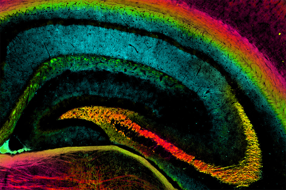 mouse hippocampus