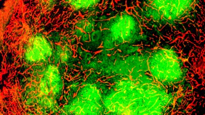 virus_cancerimmune_response.jpg